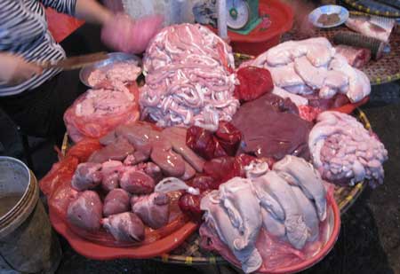 Organ Transplants